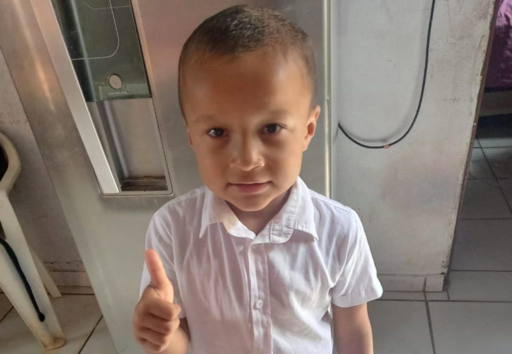 Menino de 5 anos é internado com queimaduras no rosto e no corpo após explosão de churrasqueira na casa do vizinho; VÍDEO